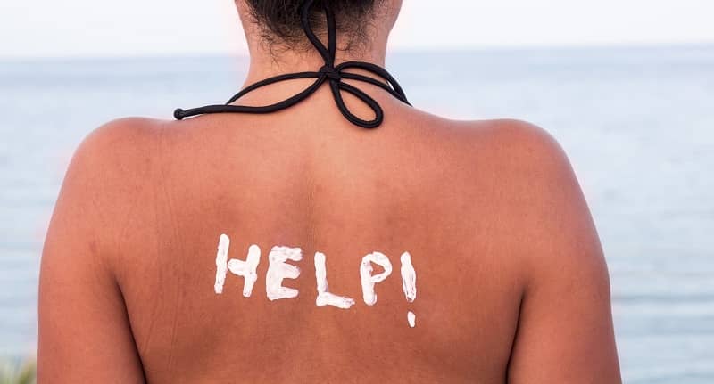 Cách chữa làn da bị cháy nắng an toàn – hiệu quả